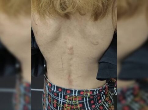 trisal-e-denunciado-por-tortura-apos-jovem-de-16-anos-fugir-de-carcere