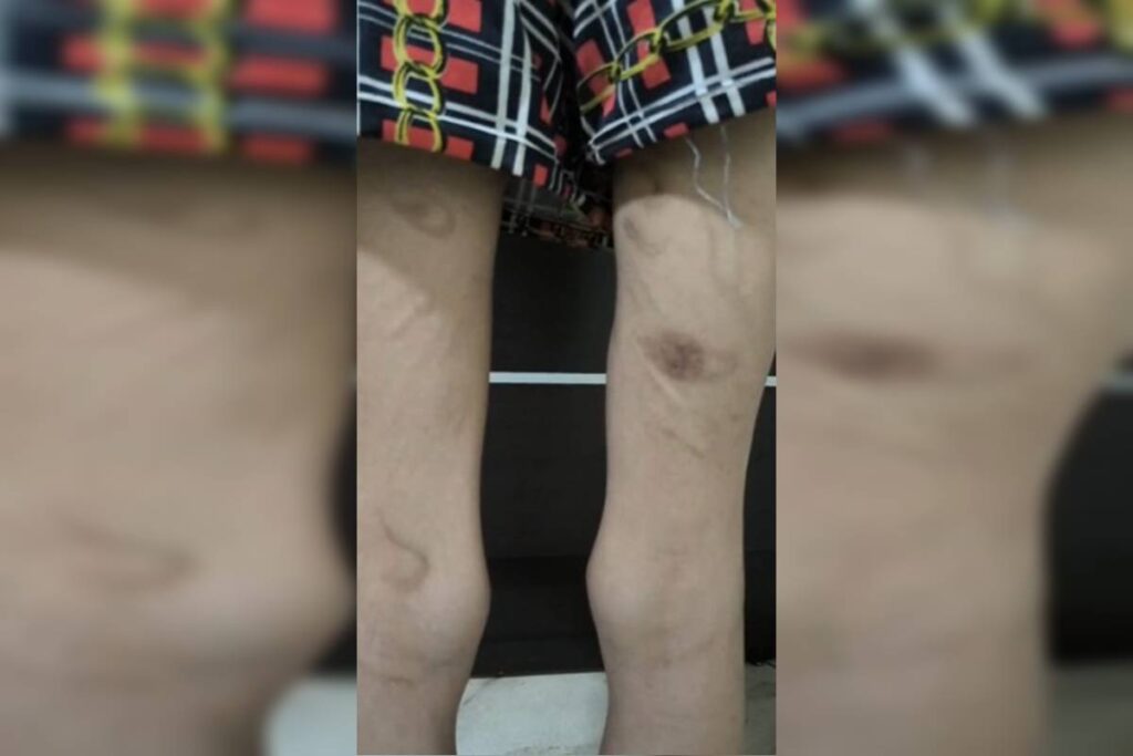 carcere:-jovem-agredida-por-trisal-em-goias-estava-“muito-debilitada”