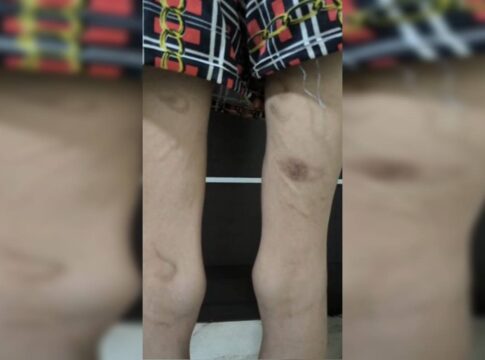 carcere:-jovem-agredida-por-trisal-em-goias-estava-“muito-debilitada”