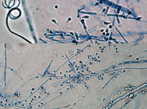 alta-em-casos-de-superfungo-que-causa-lesoes-na-virilha-acendem-alerta