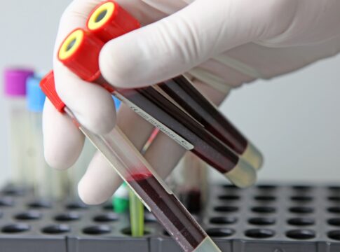 tipo-sanguineo-hibrido-raro-e-identificado-em-3-pessoas-da-tailandia