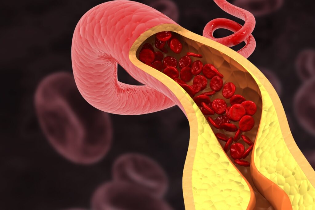 cardiologistas-apontam-habitos-que-ajudam-a-“limpar”-as-arterias