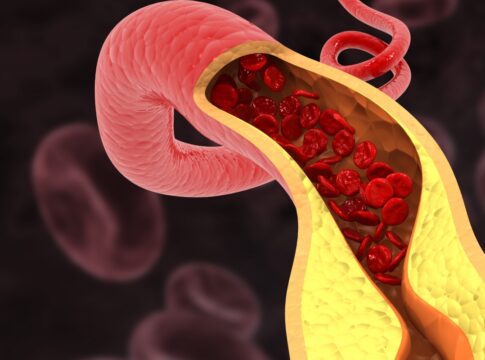 cardiologistas-apontam-habitos-que-ajudam-a-“limpar”-as-arterias