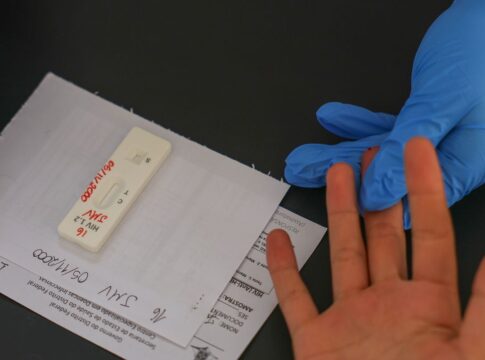 hiv/aids:-brasil-vai-insistir-em-acordo-por-prep-de-longa-duracao