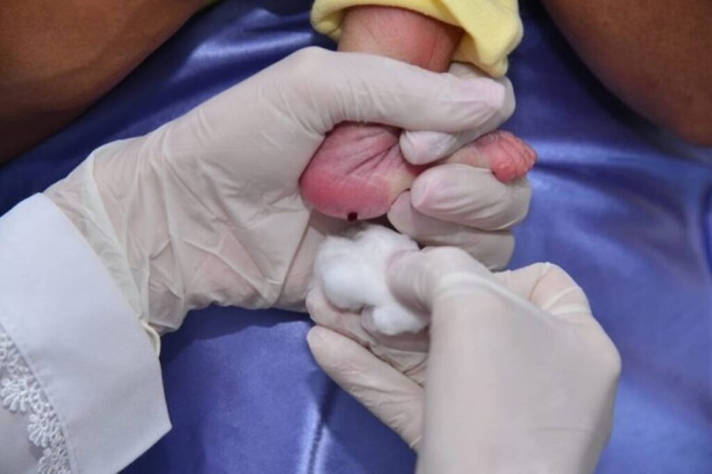 teste-do-pezinho-tera-mudanca-na-rede-publica-do-df.-entenda