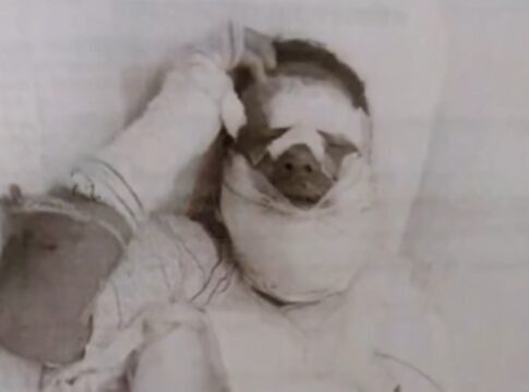 apos-briga,-homem-joga-alcool-e-ateia-fogo-no-rosto-de-companheira