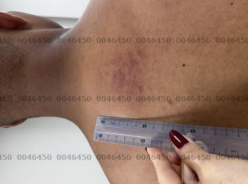 exame-de-corpo-de-delito-aponta-lesoes-em-feminicida-que-matou-cabo