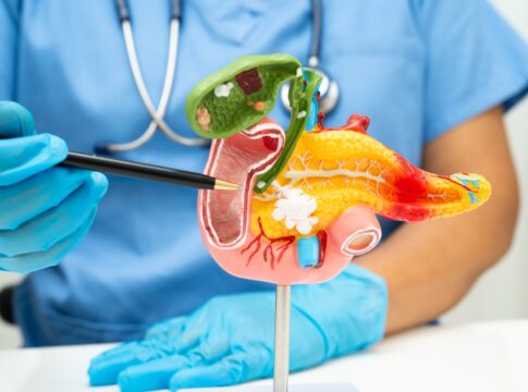 diabetes-repentina-apos-os-50-anos-pode-sinalizar-cancer-de-pancreas