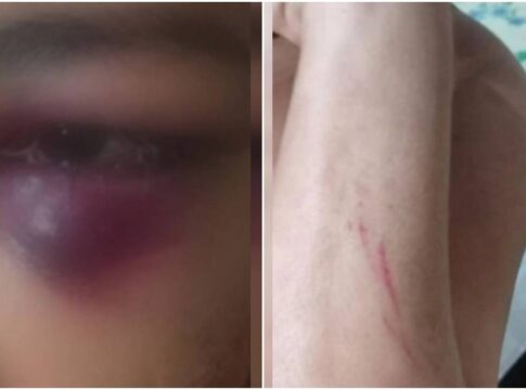 lesoes-e-olho-roxo:-mulher-e-agredida-pelo-marido-por-mais-de-12-horas