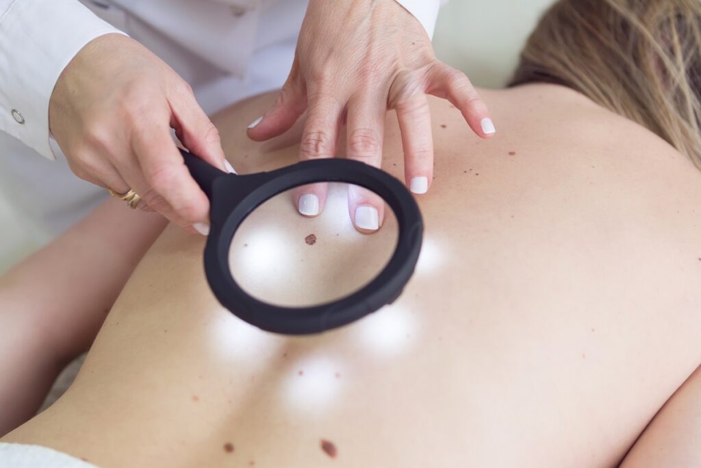 dezembro-laranja:-7-habitos-que-elevam-o-risco-de-cancer-de-pele