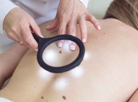 dezembro-laranja:-7-habitos-que-elevam-o-risco-de-cancer-de-pele