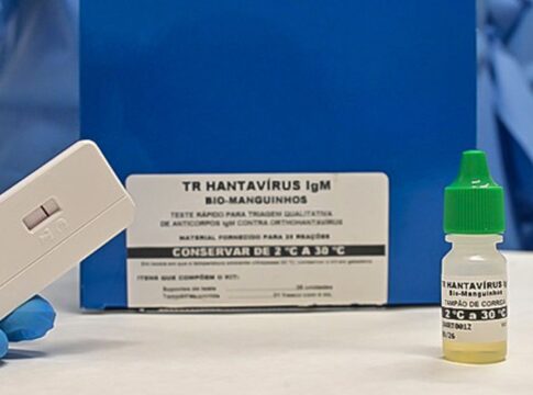 novo-teste-faz-diagnostico-de-hantavirose-em-20-minutos