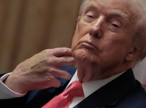 trump-precisou-de-curativo-por-conta-do-“excesso-de-apertos-de-mao”