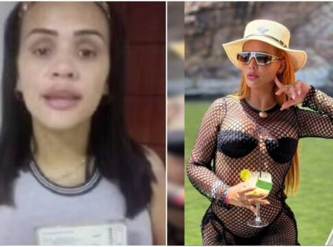 mulher-usa-grana-de-golpe-em-cirurgias-e-“antes-e-depois”-choca.-veja