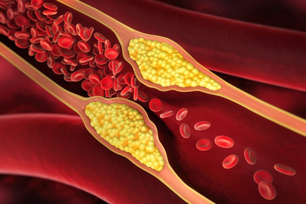 medico-vascular-cita-2-suplementos-que-beneficiam-a-saude-das-arterias