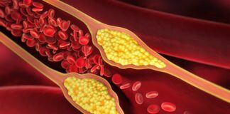 medico-vascular-cita-2-suplementos-que-beneficiam-a-saude-das-arterias