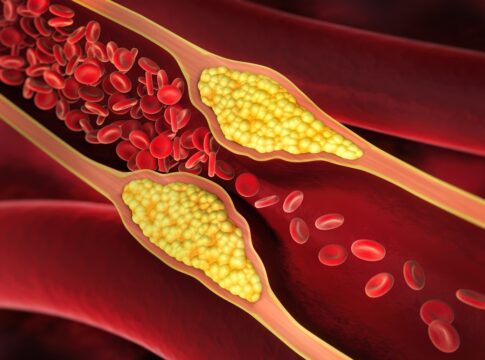 medico-vascular-cita-2-suplementos-que-beneficiam-a-saude-das-arterias