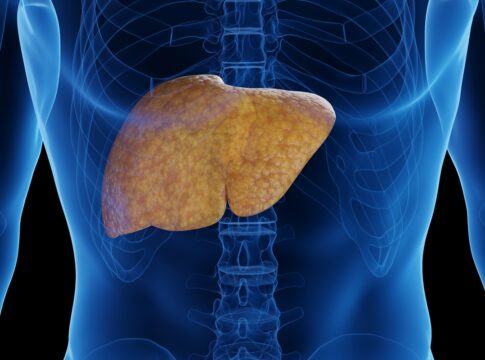 hepatologistas-contam-os-piores-alimentos-que-causam-gordura-no-figado