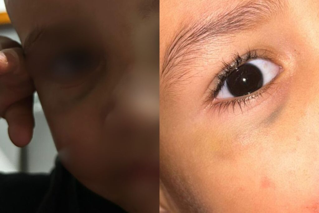 “bumbum-em-carne-viva”:-avo-relata-maus-tratos-contra-bebe-em-creche