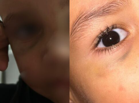 “bumbum-em-carne-viva”:-avo-relata-maus-tratos-contra-bebe-em-creche