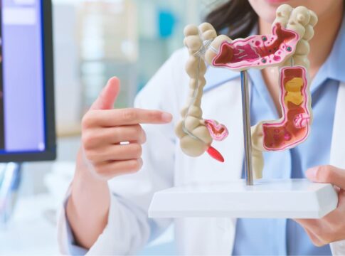 7-frutas-populares-que-apoiam-a-saude-do-intestino-e-aliviam-o-inchaco