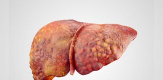 gordura-no-figado:-estudo-explica-desenvolvimento-em-pessoas-magras