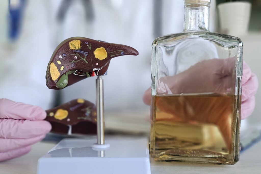 ressaca?-saiba-em-quanto-tempo-o-figado-“elimina”-o-alcool-do-corpo