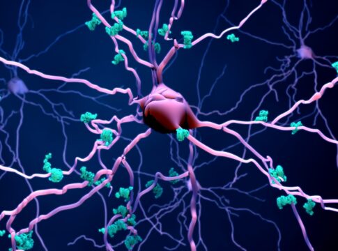 alzheimer:-medicamento-pode-reduzir-morte-de-neuronios,-indica-estudo