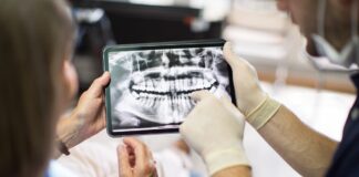 perda-de-dentes-em-idosos-piora-a-saude-e-aumenta-o-risco-de-morte