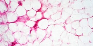 cientistas-conseguem-potencializar-celulas-para-queimar-mais-calorias