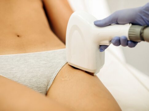 clinica-queima-regiao-intima-de-cliente,-que-ganha-r$-50-mil-por-danos