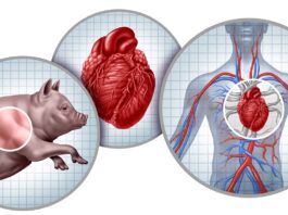 xenotransplante:-medicos-dizem-como-tecnica-promissora-avancou-em-2025