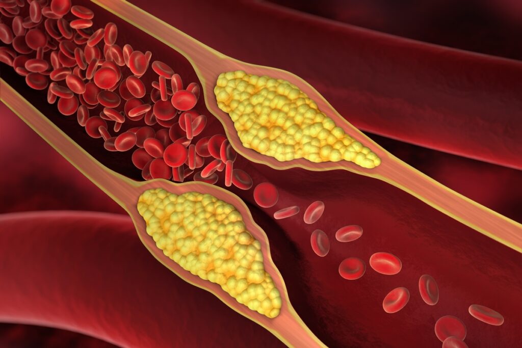 medico-vascular-cita-frutas-populares-que-ajudam-na-saude-das-arterias