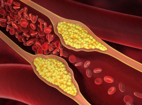 medico-vascular-cita-frutas-populares-que-ajudam-na-saude-das-arterias