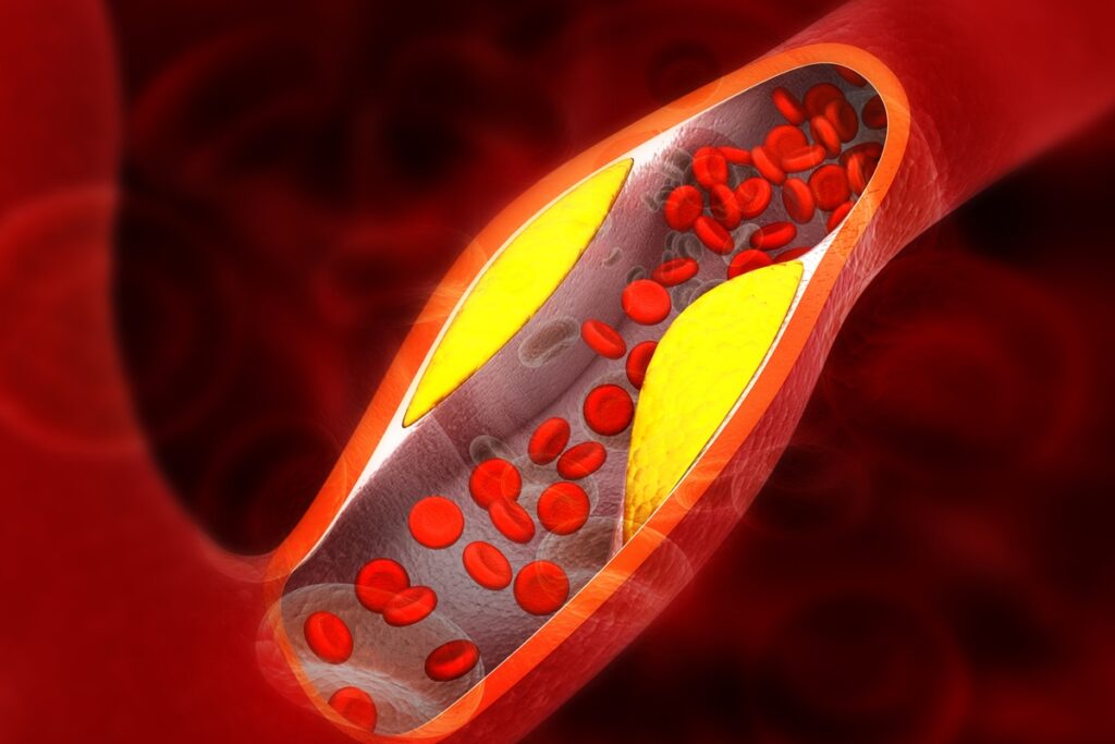 medico-vascular-aponta-6-vegetais-que-beneficiam-a-saude-das-arterias