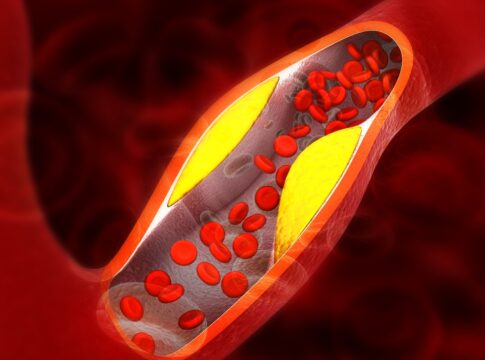 medico-vascular-aponta-6-vegetais-que-beneficiam-a-saude-das-arterias