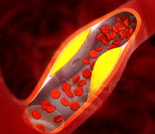 medico-vascular-aponta-6-vegetais-que-beneficiam-a-saude-das-arterias