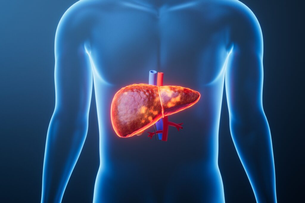 sinais-que-o-figado-da-por-nao-funcionar-bem-apos-o-excesso-de-alcool