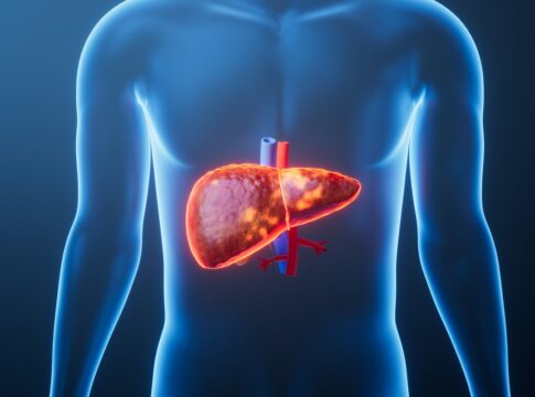 sinais-que-o-figado-da-por-nao-funcionar-bem-apos-o-excesso-de-alcool