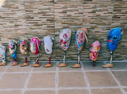 a-vida-de-uma-crianca-amputada.-como-funciona-acesso-a-proteses-em-sp