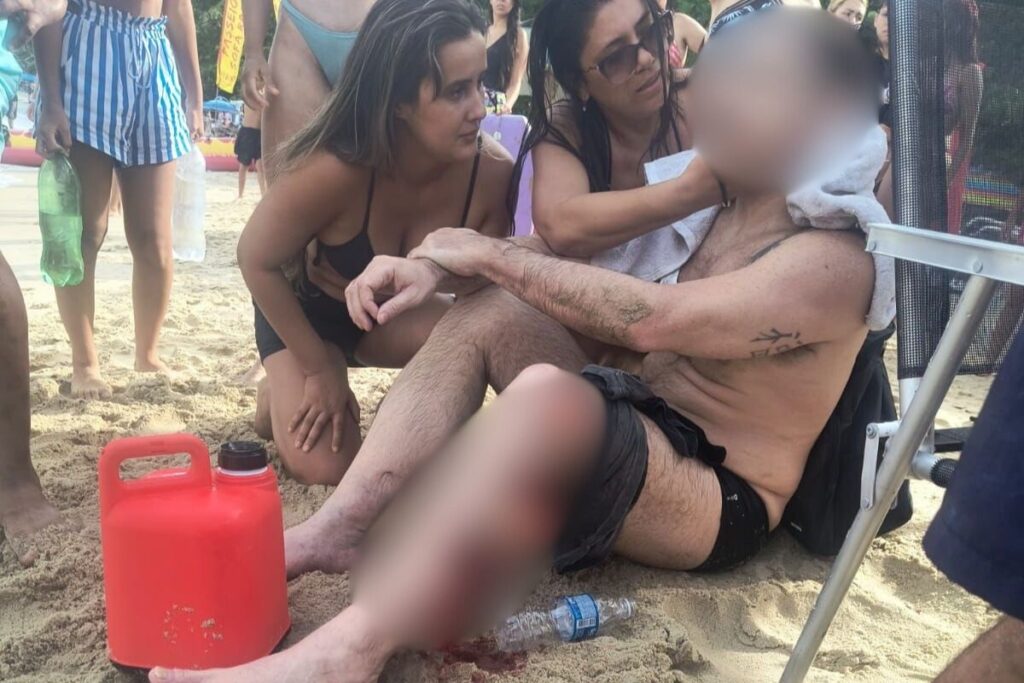 atropelado-por-lancha,-banhista-tem-perna-lacerada-no-litoral-de-sp