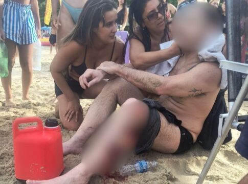 atropelado-por-lancha,-banhista-tem-perna-lacerada-no-litoral-de-sp