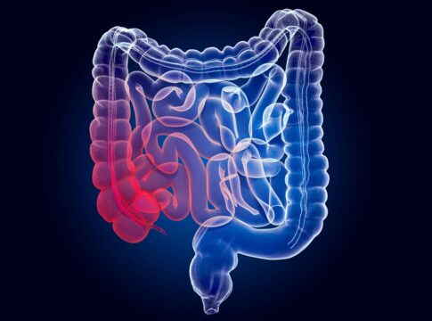 tres-frutas-saborosas-que-ajudam-a-reduzir-a-inflamacao-no-intestino
