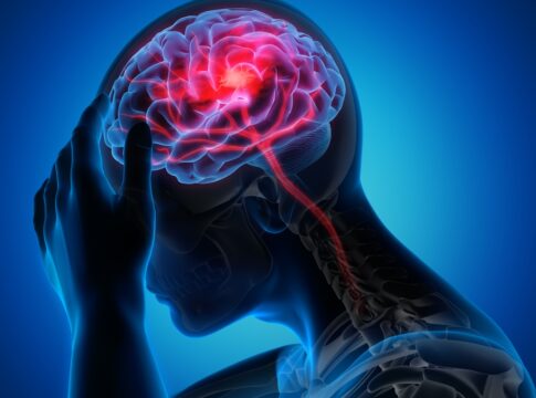 neurologistas-explicam-quais-sao-as-sequelas-mais-comuns-do-avc