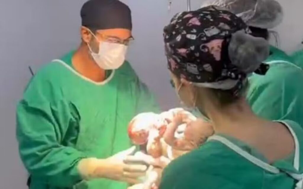 “papel-e-tentar-salvar-a-vida”,-diz-medico-apos-morte-de-siameses