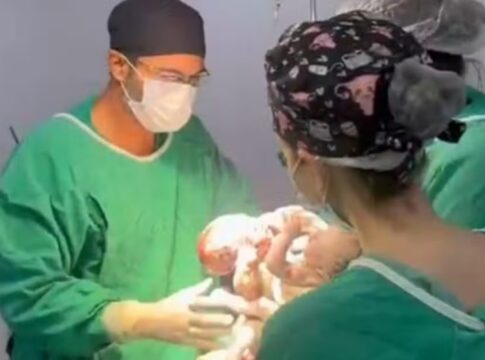 “papel-e-tentar-salvar-a-vida”,-diz-medico-apos-morte-de-siameses