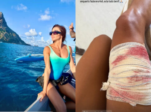 advogada-e-mordida-por-tubarao-ao-fazer-snorkel-em-fernando-de-noronha