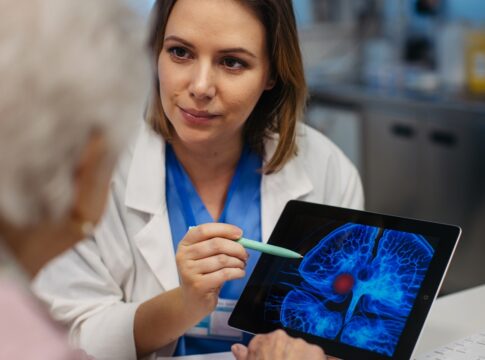 nutricionista-revela-alimentos-que-ajudam-a-reduzir-os-ricos-de-avc