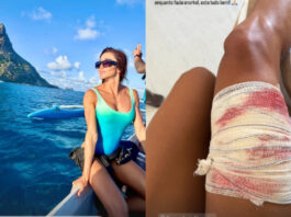 noronha:-veja-exato-momento-em-que-surfista-e-mordida-por-tubarao.-veja-video