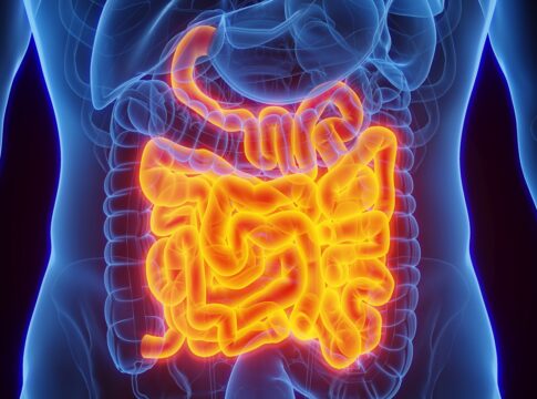 nutri-cita-alimentos-que-ajudam-a-combater-a-inflamacao-do-intestino